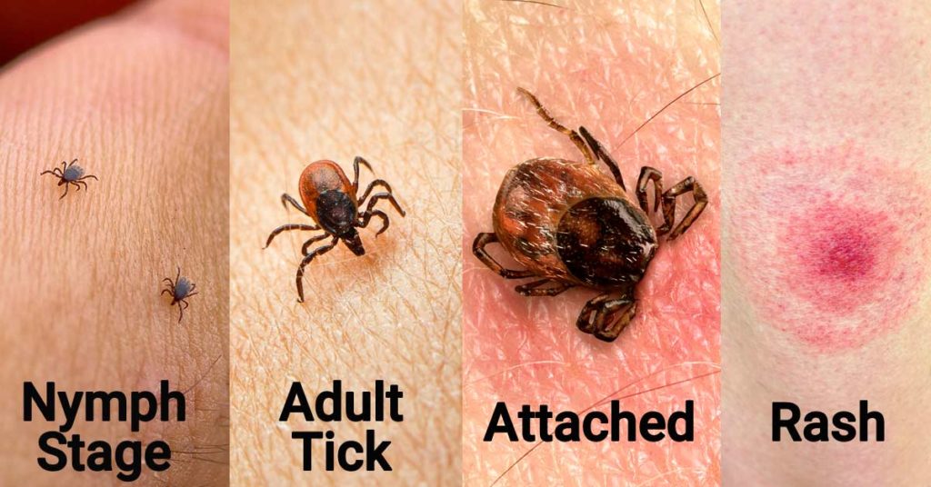 everything-you-need-to-know-about-lyme-disease-the-life-greek